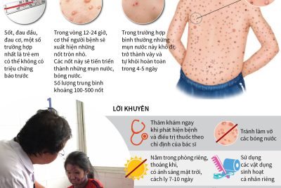 Bài tuyên truyền phòng chống bệnh thủy đậu.